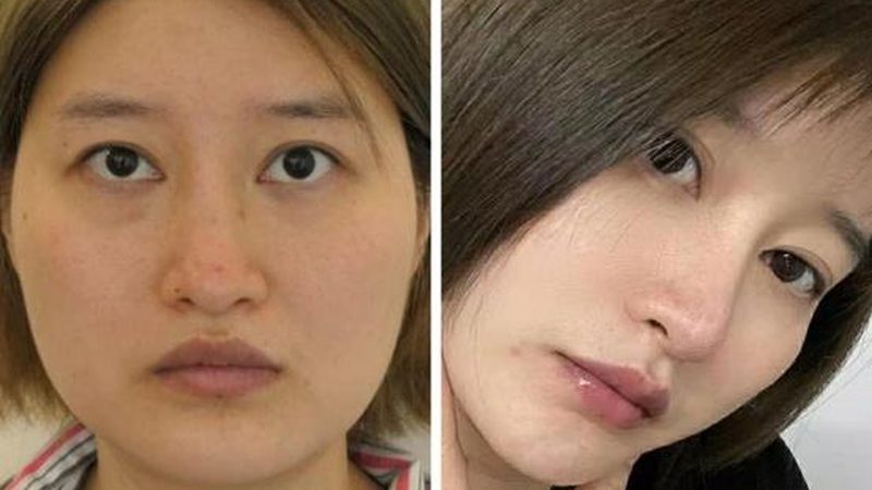 轻医美品牌效果持久性排名