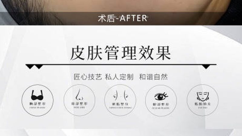 注射美容国产和进口品牌区别