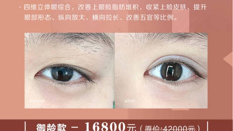 肉毒素去狐臭，了解注射针数的关键