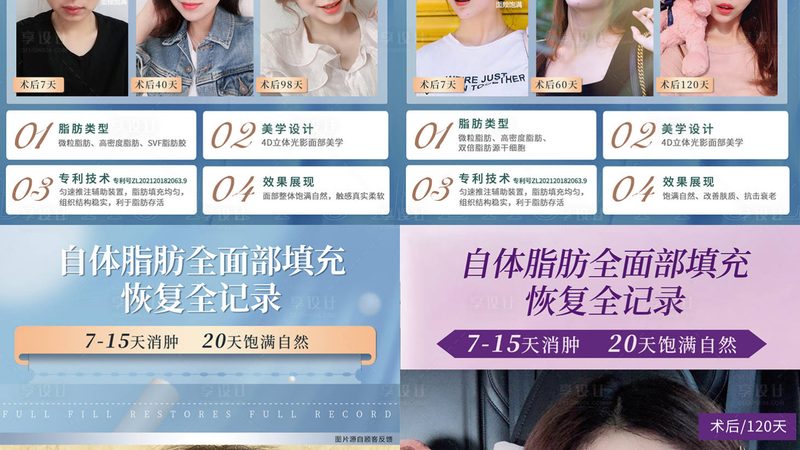 埋线提升超声刀后，效果显现的时间揭秘