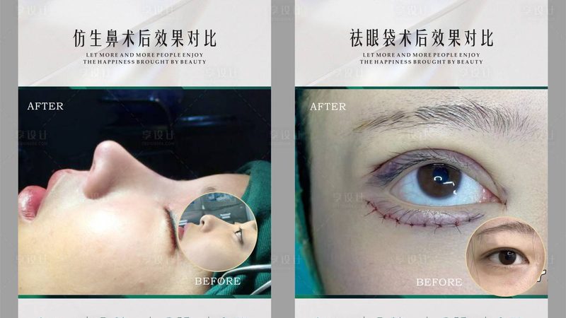 术后初期：休息与护理