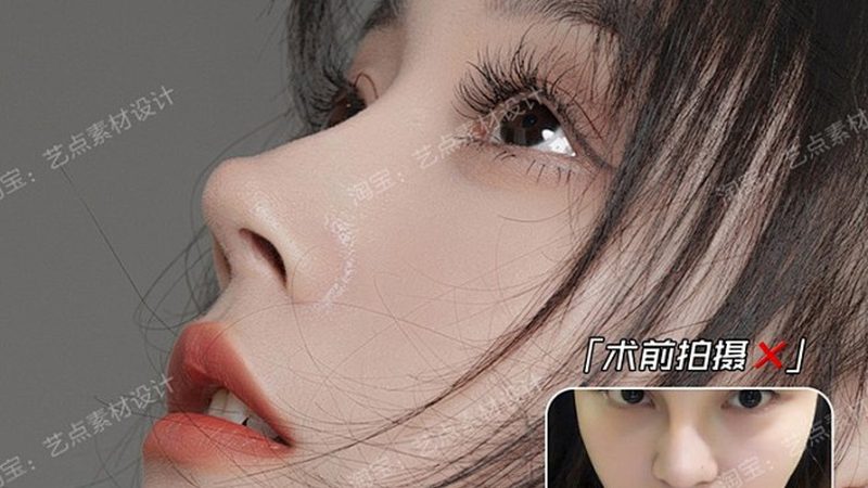 在选择玻尿酸时，需要根据自身需求和注射部位的特点来选择。以下是一些选购要点：