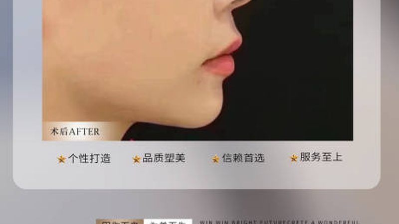 2025年，上海水光针：揭秘价格背后的秘密**