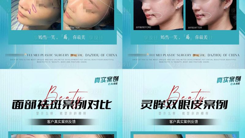 双眼皮手术价格：2025年你该了解的真相