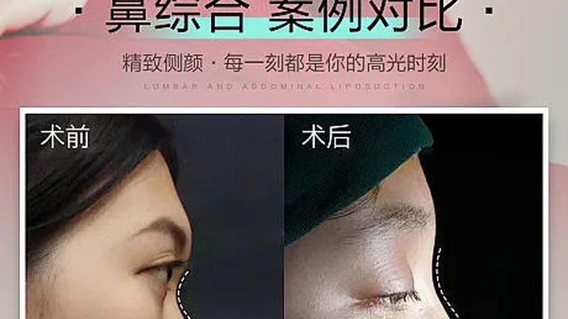 瘦脸按摩手法步骤教程注意事项