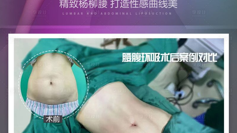 光子嫩肤VS强脉冲光：价格差异背后的技术解析