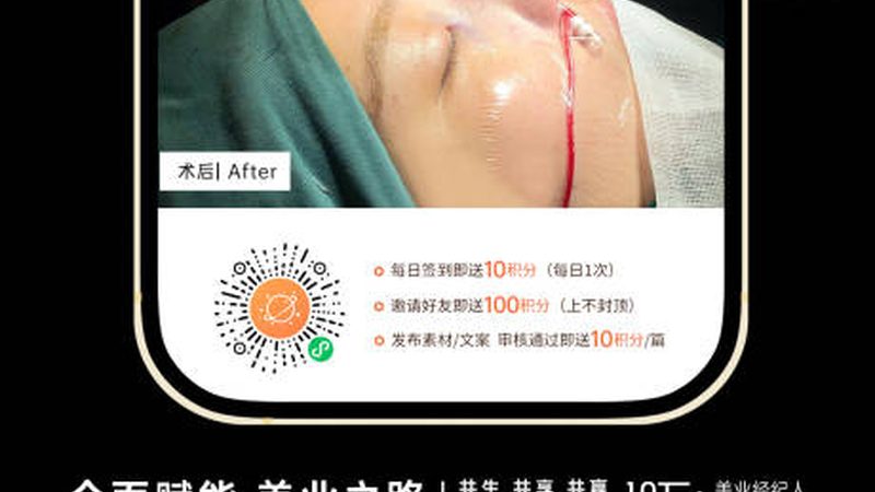 皮秒祛斑VS激光祛斑：性价比之争，揭秘真相
