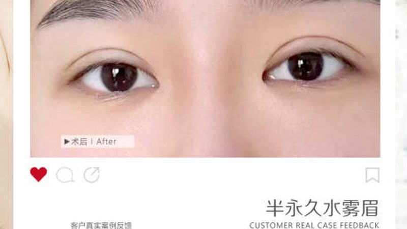 广州隆鼻价格：揭秘影响因素及合理预期