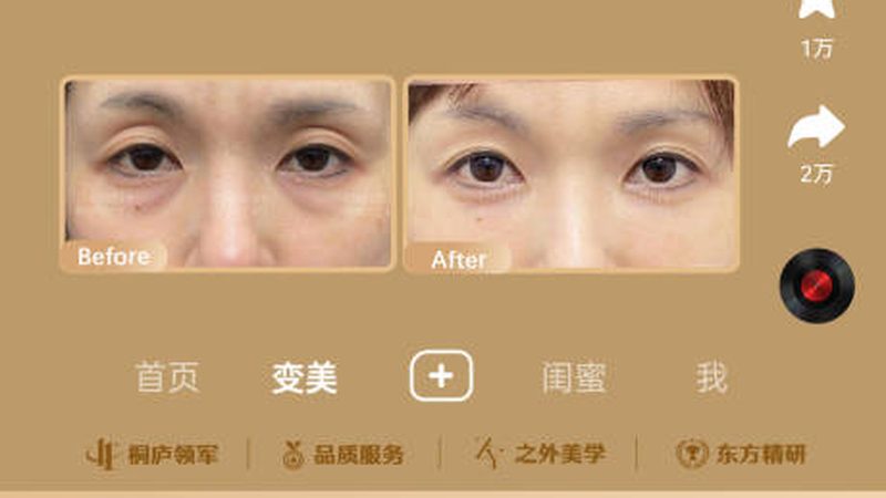 玻尿酸面膜敷完要不要涂面霜