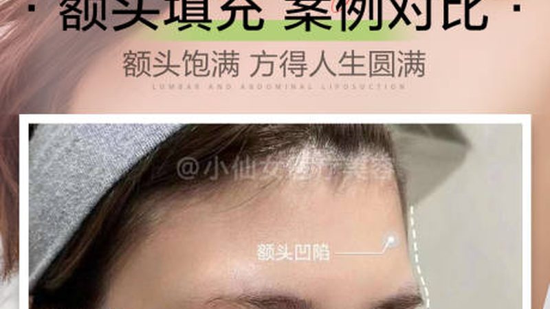 上海打瘦脸针，揭秘适合哪些人群