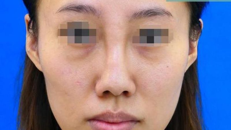 美容院激光设备选型：揭秘如何找到最适合的“神器”**
